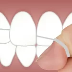 Why It’s Beneficial to Remove Plaque From Your Teeth